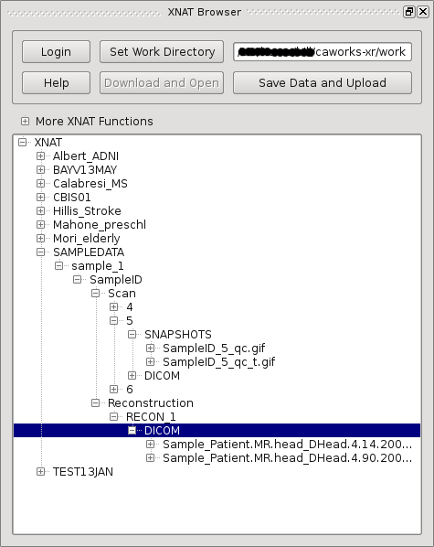 http://caportal.cis.jhu.g.sjuku.top/wiki/tutorials/xnat_browser_documentation/CAWorks_XnatBrowser_5.png